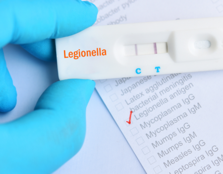Legionella Prevention: What is ACOP L8?
